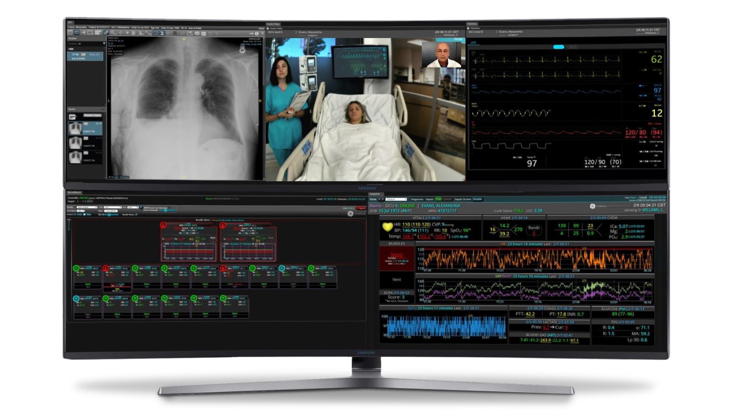 GE Healthcare and Microsoft announce new tech to help clinicians support COVID-19 patients