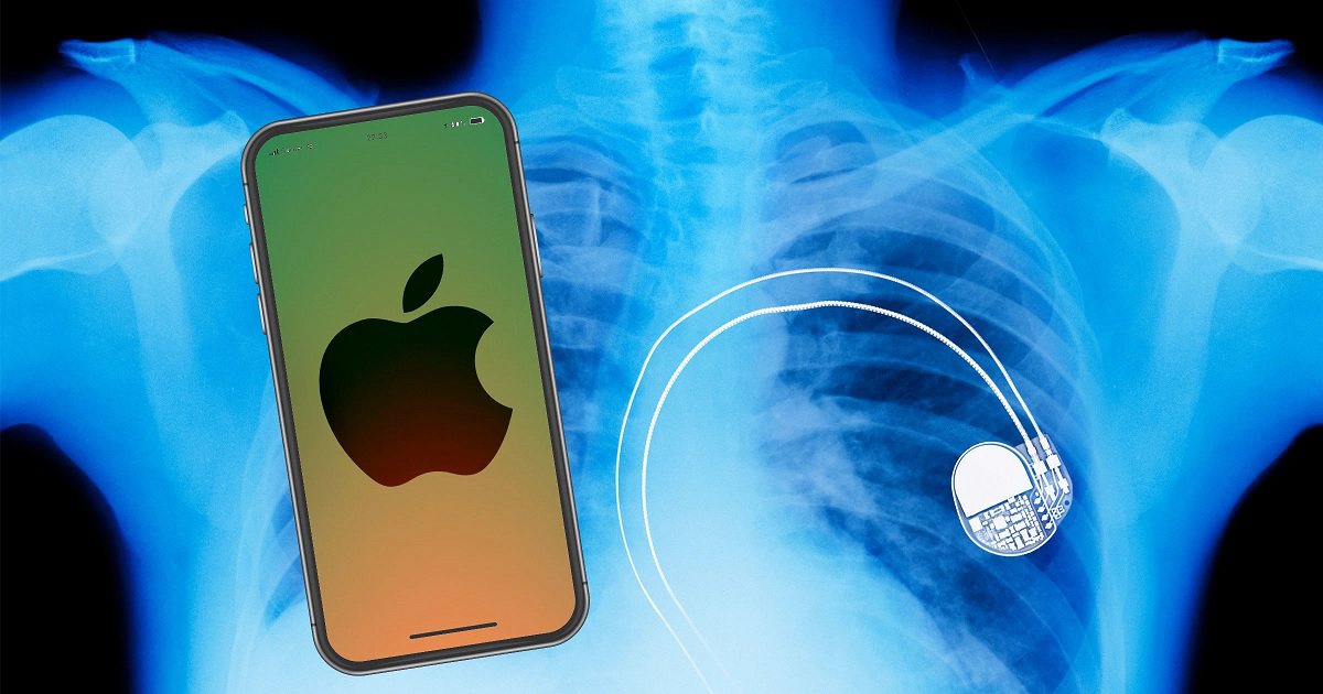 iphone 12 pacemaker